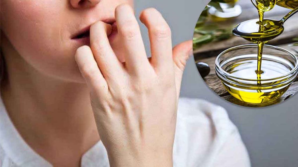 Comment arrêter de se ronger les ongles. La méthode naturelle à trouver — free download