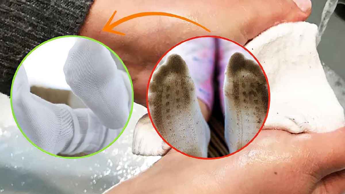 Comment retrouver la blancheur de vos chaussettes sales ?