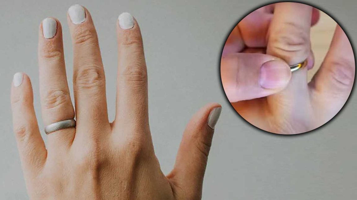 Astuce infaillible pour enlever une bague sur un doigt gonflé